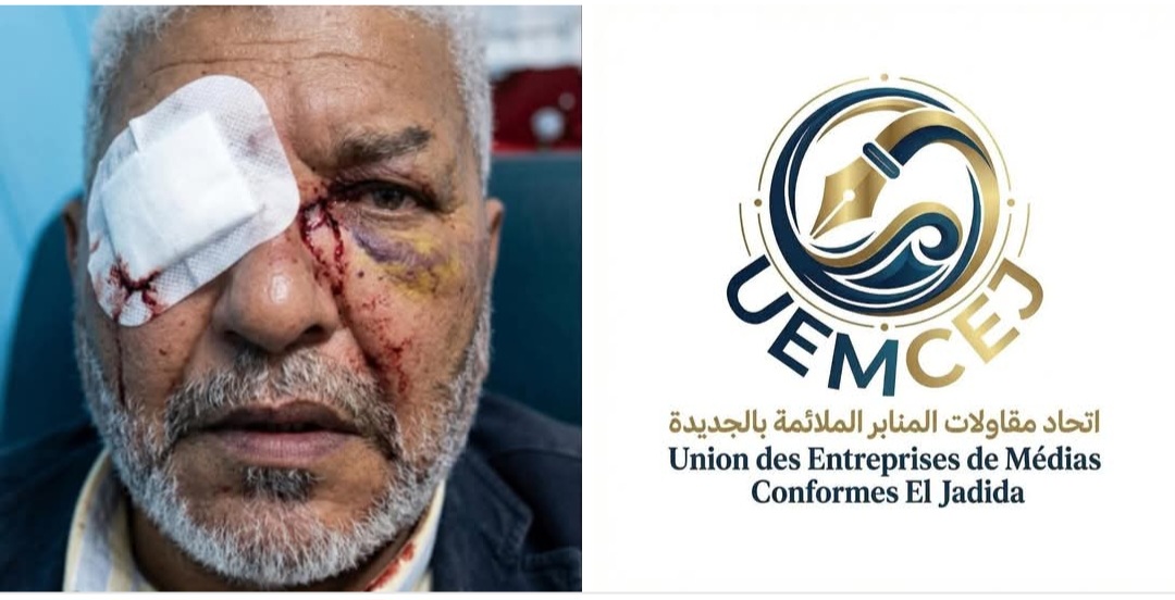 اتحاد المنابر الاعلامية بالجديدة يستنكر  الاعتداء الدي تعرض له الزميل محمد الدغمي