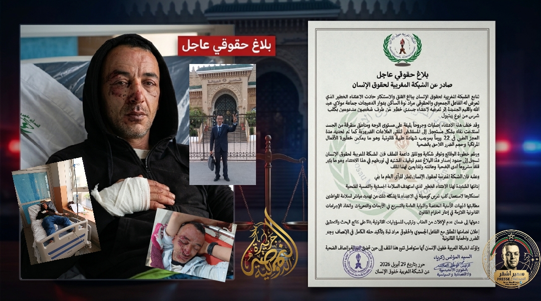 اعتداء خطير على الفاعل الحقوقي مراد نوة يثير مطالب بتسريع العدالة و القبض على المعتدين